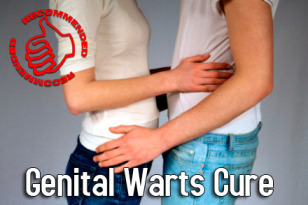 What does genital warts look like