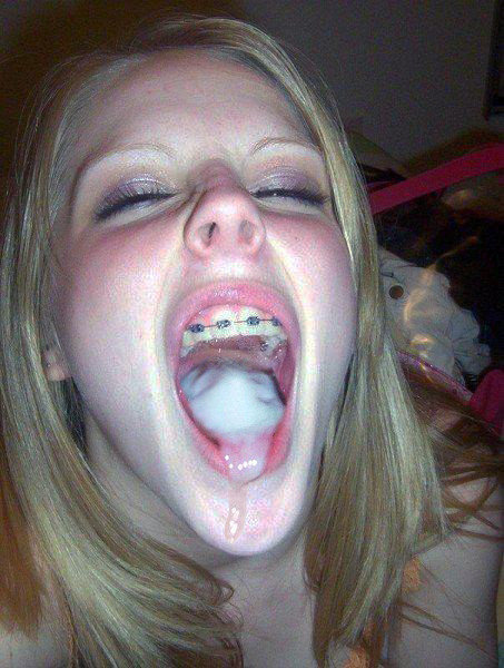 Teen girl braces mouth open tongue