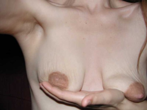 Mom small tits stretch marks