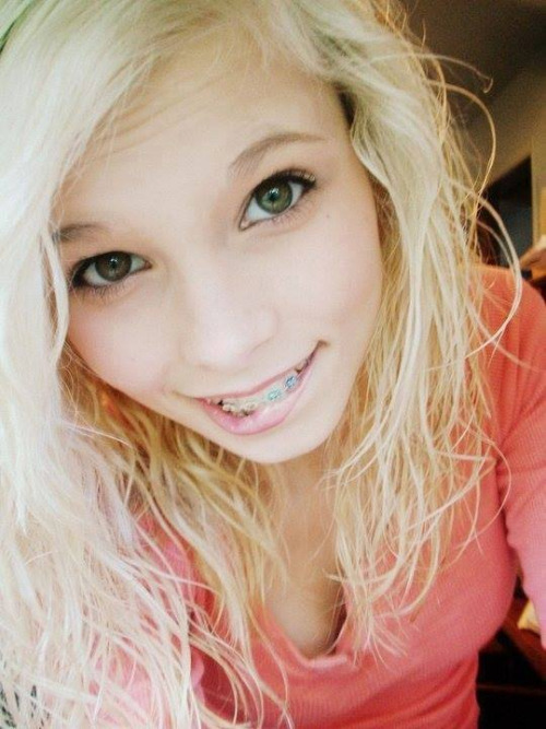 Cute girl young teens with braces