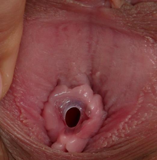 Virgin pussy hymen close up